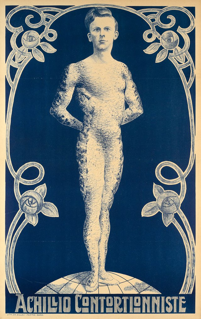 Achillio Contortionniste